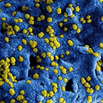 Bereid u voor op mogelijke gevolgen van het Coronavirus - Corona bacterie